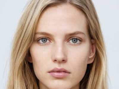 长沙微针去黄褐斑手术价格一览：医院推荐与医生选择指南