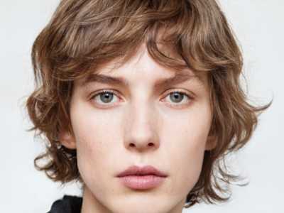 昆明做眼部除皱整形正规医院推荐