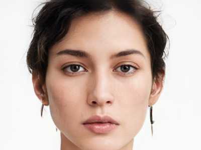 松原自体组织垫鼻出整形失败后遗症