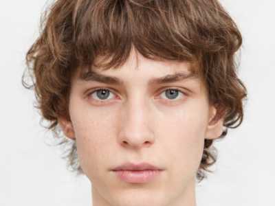 济南内眼角提拉手术效果维持及术后护理全解析，美丽蜕变从了解开始