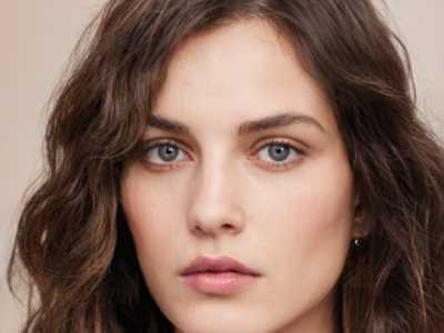 熊伟汉整形医生-熊伟汉医师下颌突出矫正手术效果太绝了