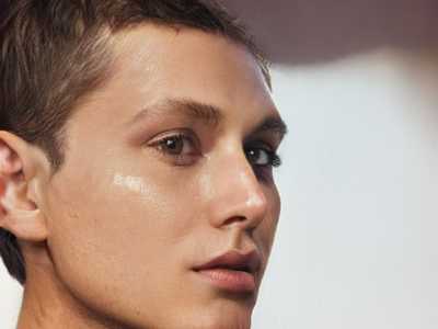 传统托槽正畸的手术效果