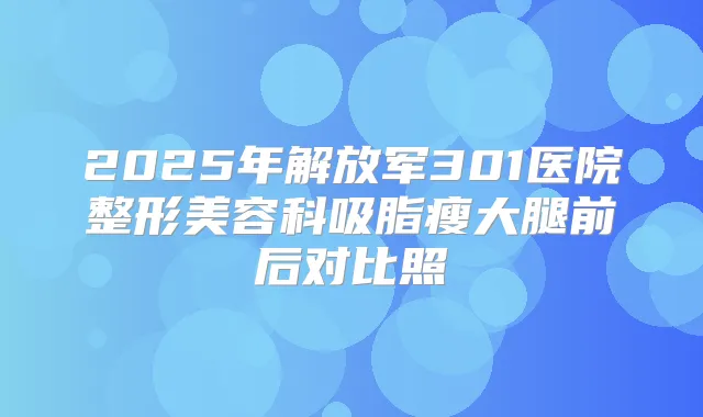 2025年解放军301医院整形美容科吸脂瘦大腿前后对比照