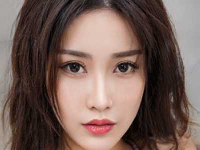 中国人民解放军总医院第四医学中心烧伤整形科价格收费表全新推出-精细无痕双眼皮案例