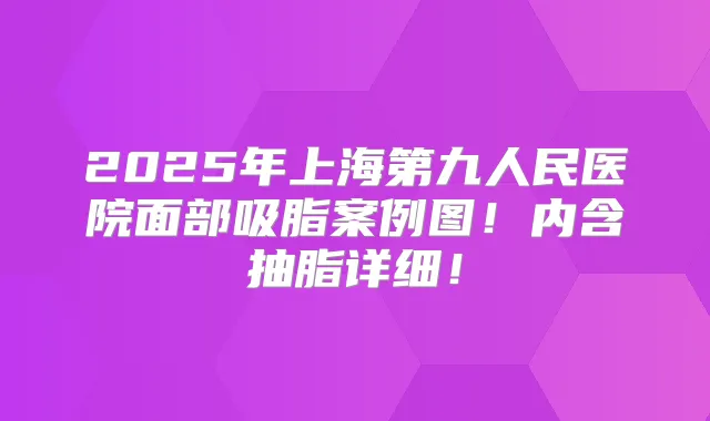 2025年上海第九人民医院面部吸脂案例图！内含抽脂详细！