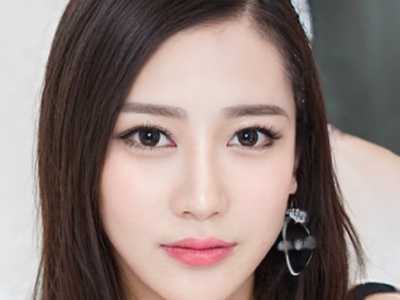 看看苏州市纳米无痕眼睑医生TOP9