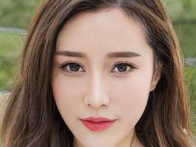 晋中埋线双眼皮修复修复修复是否安全