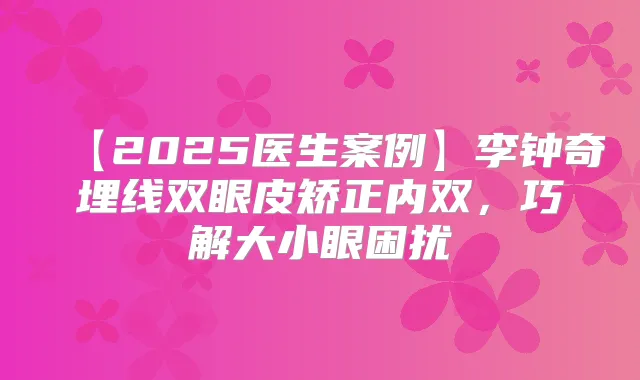 【2025医生案例】李钟奇埋线双眼皮矫正内双，巧解大小眼困扰