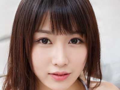 郑州大学第五附属医院整形外科整形价格收费表2026优惠巨献-鼻翼角上提手术案例