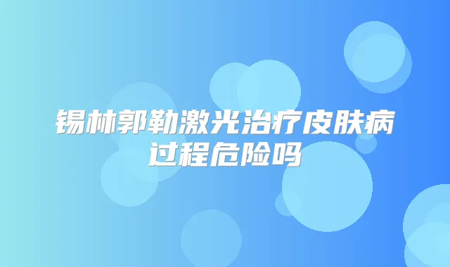 锡林郭勒激光皮肤病过程危险吗