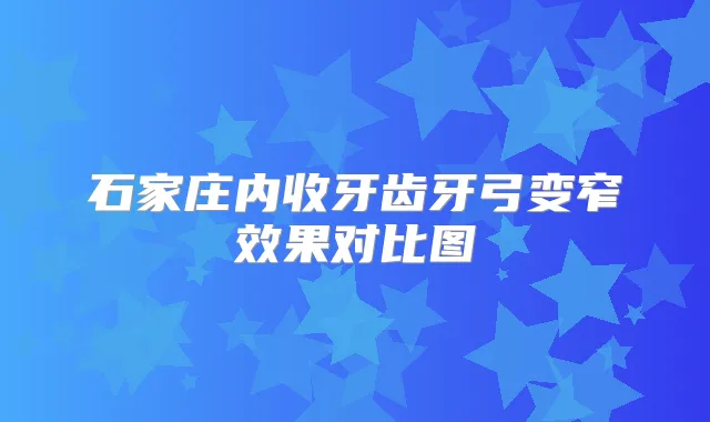 石家庄内收牙齿牙弓变窄效果对比图