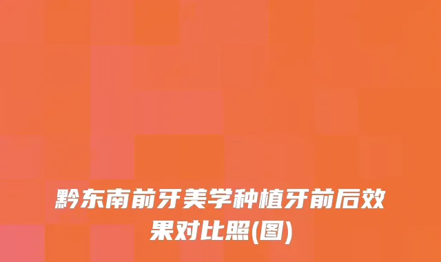 黔东南前牙美学种植牙前后效果对比照(图)