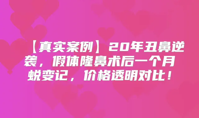 【真实案例】20年丑鼻逆袭,假体隆鼻术后一个月蜕变记,价格透明对比!