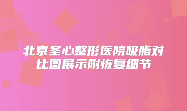 北京圣心整形医院吸脂对比图展示附恢复细节