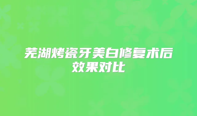 芜湖烤瓷牙美白修复术后效果对比