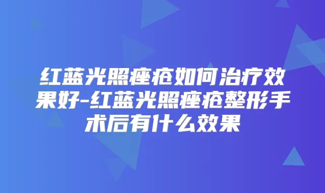 红蓝光照痤疮如何效果好-红蓝光照痤疮整形手术后有什么效果