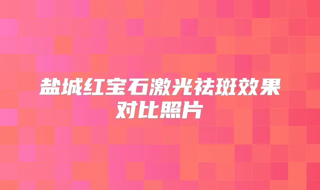 盐城红宝石激光祛斑效果对比照片