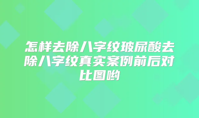 怎样去除八字纹玻尿酸去除八字纹真实案例前后对比图哟