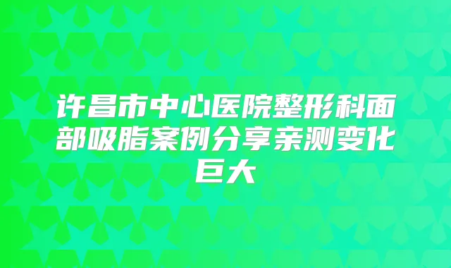 许昌市中心医院整形科面部吸脂案例分享亲测变化巨大