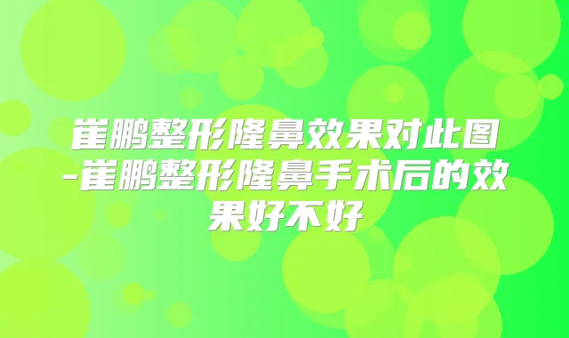 崔鹏整形隆鼻效果对此图-崔鹏整形隆鼻手术后的效果好不好