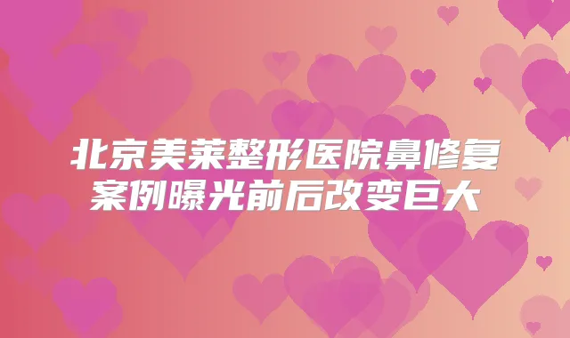 北京美莱整形医院鼻修复案例曝光前后改变巨大