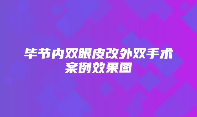 毕节内双眼皮改外双手术案例效果图