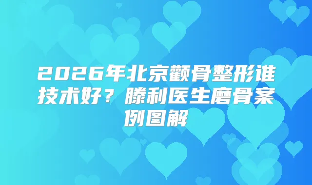 2026年北京颧骨整形谁技术好？滕利医生磨骨案例图解