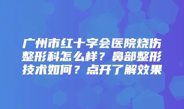广州市红十字会医院烧伤整形科怎么样?鼻部整形技术如何?点开了解效果