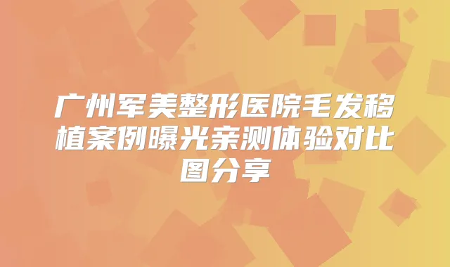 广州军美整形医院毛发移植案例曝光亲测体验对比图分享