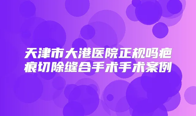 天津市大港医院正规吗疤痕切除缝合手术手术案例