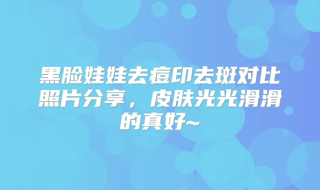 黑脸娃娃去痘印去斑对比照片分享,皮肤光光滑滑的真好~