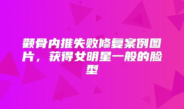 颧骨内推失败修复案例图片,获得女明星一般的脸型