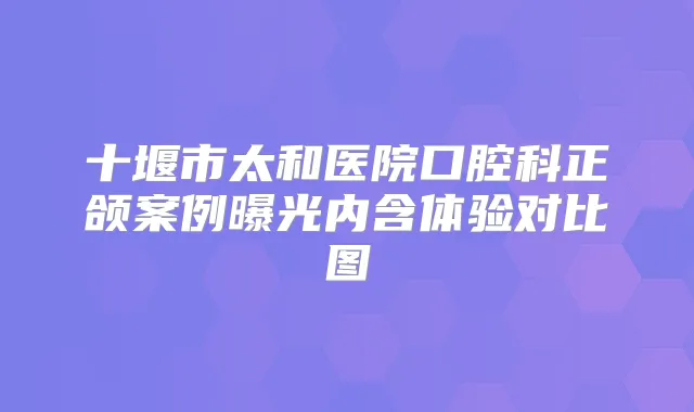十堰市太和医院口腔科正颌案例曝光内含体验对比图