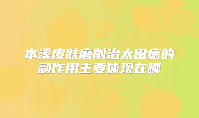 本溪皮肤磨削治太田痣的副作用主要体现在哪