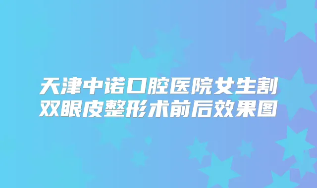 医院女生割双眼皮整形术前后效果图