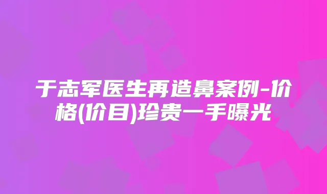 于志军医生再造鼻案例-价格(价目)珍贵一手曝光