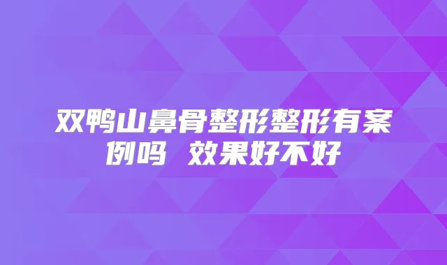 双鸭山鼻骨整形整形有案例吗 效果好不好