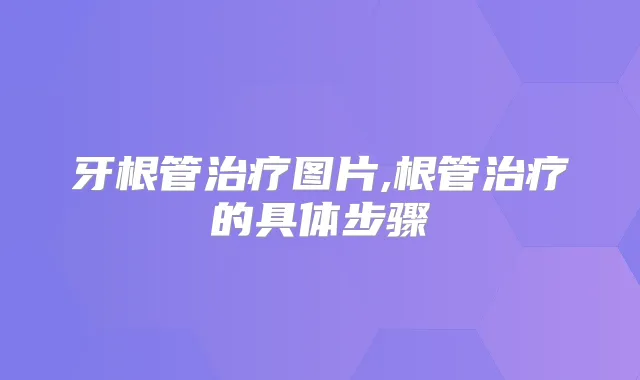 牙根管图片,根管的具体步骤