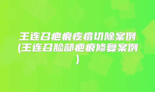 王连召疤痕疙瘩切除案例(王连召脸部疤痕修复案例)