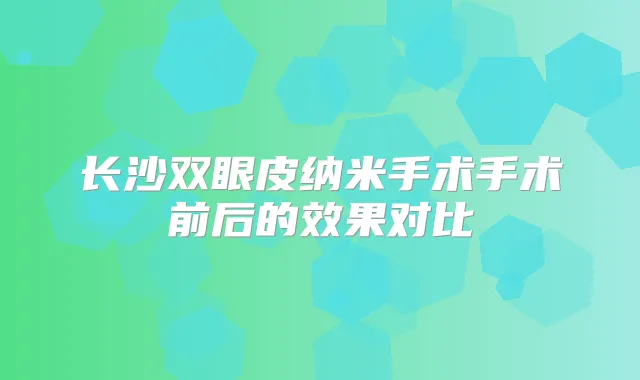 长沙双眼皮纳米手术手术前后的效果对比