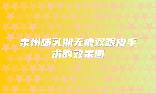 泉州哺乳期无痕双眼皮手术的效果图