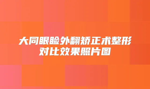 大同眼睑外翻矫正术整形对比效果照片图
