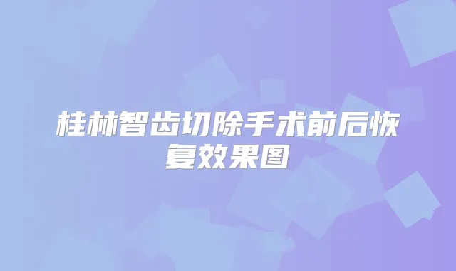 桂林智齿切除手术前后恢复效果图