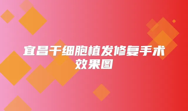 宜昌干细胞植发修复手术效果图