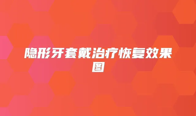 隐形牙套戴恢复效果图