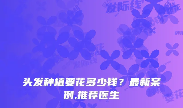 头发种植要花多少钱？新案例,推荐医生