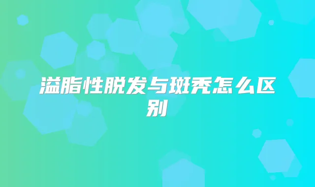 溢脂性脱发与斑秃怎么区别