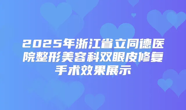 2025年浙江省立同德医院整形美容科双眼皮修复手术效果展示