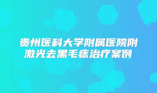 贵州医科大学附属医院附激光去黑毛痣案例