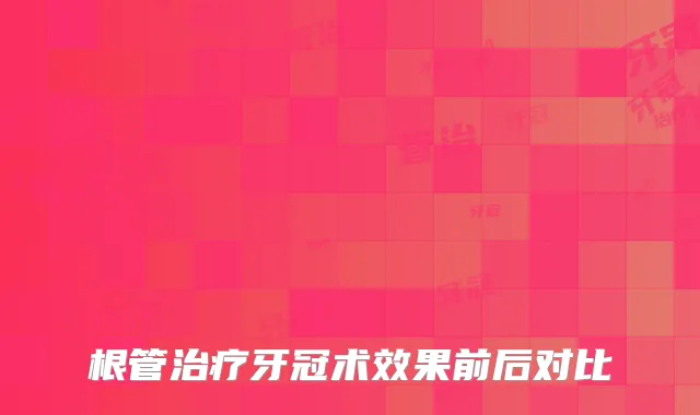 根管牙冠术效果前后对比
